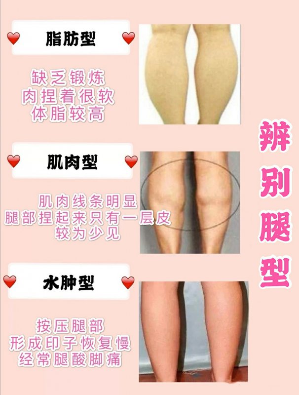 林芊妤瘦小腿周六野瘦小腿2脂包肌小腿很多人的小腿都是这种类型(我