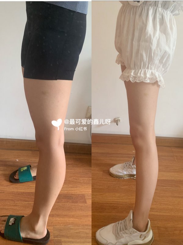 不同腿型瘦腿方法60告别脂包肌肌肉腿