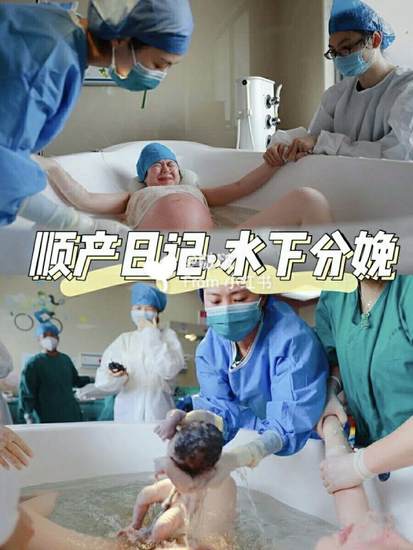 选择水中分娩不后悔产后妊娠纹
