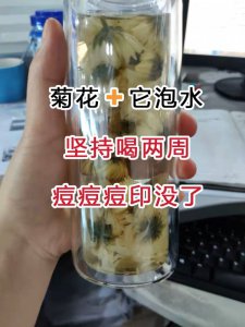菊花泡茶坚持喝两周痘痘痘印都没了！