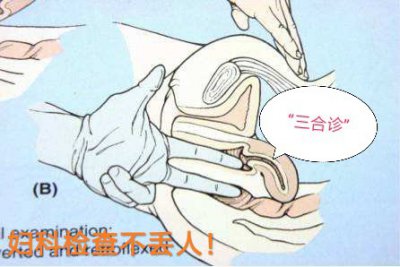 女生妇科检查攻略（下）：行动篇