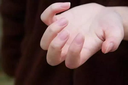 指甲薄、脆 轻易断裂 或许是身体发出的求救信号 别忽视了