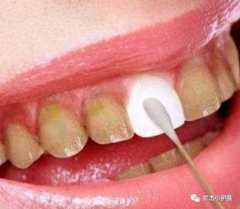 天天刷牙为何还是牙黄口臭？教大家几个小妙招 让你告别大黄牙