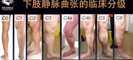 这家医院有群穿丝袜的男人 原因又暖又辛酸