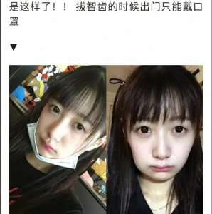 拔智齿是什么体验？拔前VS拔后 网友：这是捅了马蜂窝吗？