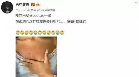 吉克隽逸被猫抓伤 夏季动物致伤已进入高发期