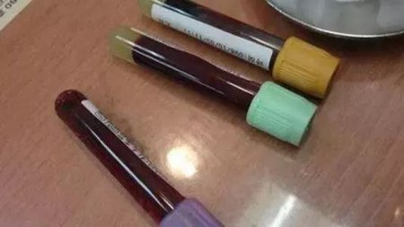 不小心被乙肝病人的血扎了 怎么办？别慌 瞧瞧老司机的经验之谈