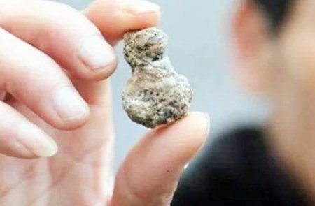 它是天然的碎石机 每日多吃点 或轻松排除体内结石