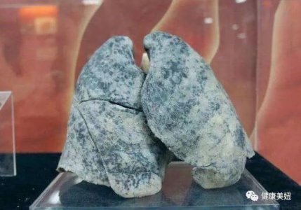 乙肝克星找到 蜂蜜配它泡水喝 肝毒逃之夭夭