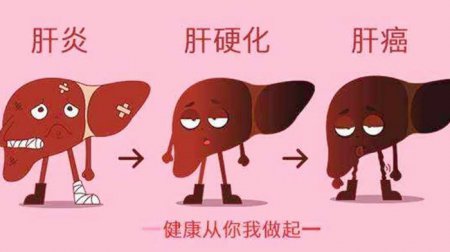 它是肝炎的救星 经常吃 修复肝损伤 肝硬化 肝癌不来扰