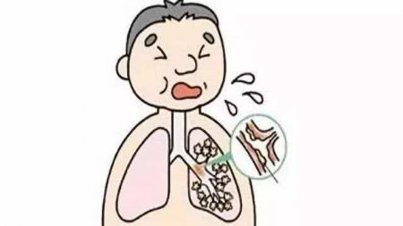 咳嗽的时候 从肺里面排出来的物质 究竟是什么