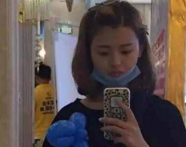 杨超越整容照片曝光 以前单眼皮变成了现在双眼皮