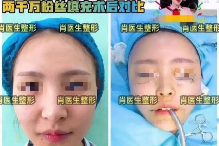 快手猫妹妹整容 深夜直播自曝自己整容失败