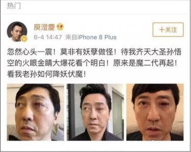 庾澄庆血眼吓懵网友 眼睛充血严重看似要爆出来