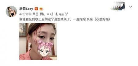 唐菀晒收工惨照 宝宝看来唐菀“受伤”竟然大哭起来