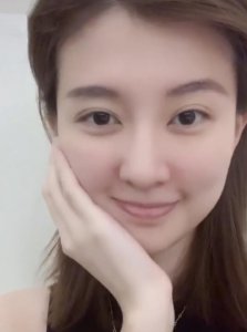 乔欣拔完智齿后 脸颊肿胀网友怀疑是不是开了特效