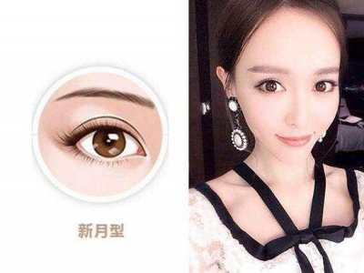 爱美的时代 双眼皮类型有哪些图片大全