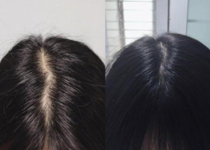 俗话说&ldquo;头发三分靠发型 护理头发的小窍门和妙招