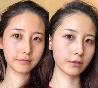 大家都说女人最美好的年纪是在十八岁 女人多少岁开始衰老？开始衰老的表现