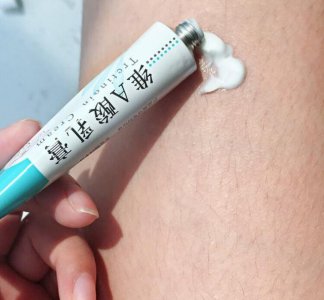 夏天女生都免不了穿短裤、裙子 鸡皮肤怎么消除有效果？