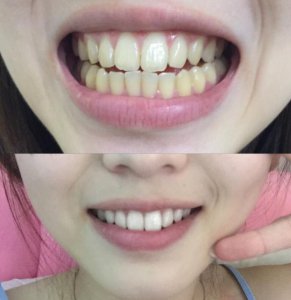 女孩子给人的感觉应该就是干干净净的 什么样的女生最令人讨厌？