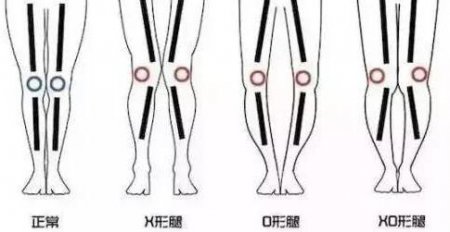 其实 如何根据腿型挑选合适的牛仔裤？