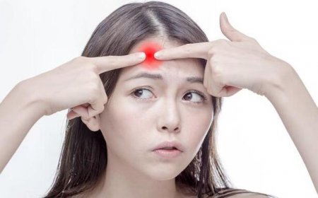 我们脸上的各个部位都会产生非常多的痘痘 额头眉心起痘痘是什么原因？