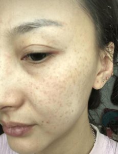 我们皮肤的颜色大部分都跟基因有关 怎样才能让皮肤变白小妙招方法
