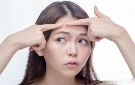 油性皮肤长痘的几率是最大的 油性皮肤长痘怎么办？