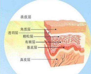 冬天皮肤干燥起皮是正常现象了 脸上干燥起皮怎么办？