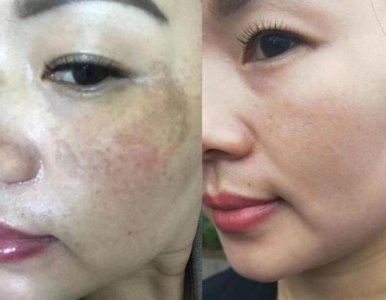 美白祛斑 正确的美白方法有哪些？