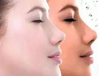 皮肤暗黄这个问题非常常见 如何改善皮肤暗黄的方法