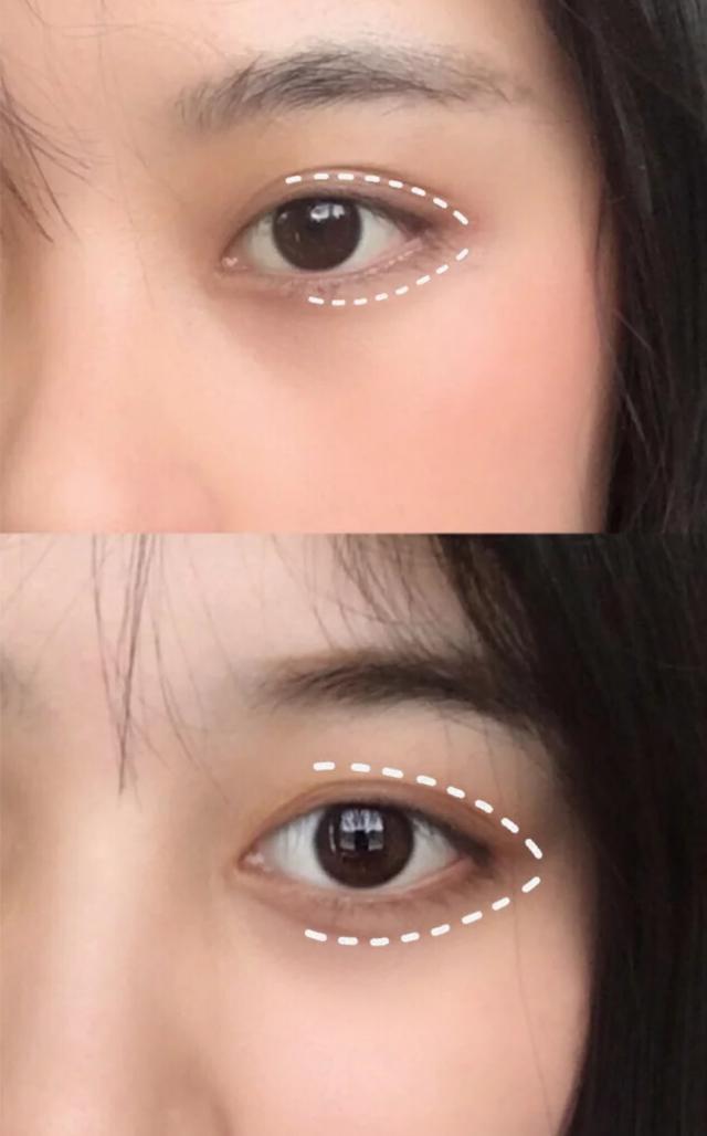眼尾下垂