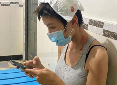 张蓝心拍戏头部受伤 头上包裹着纱布血迹明显