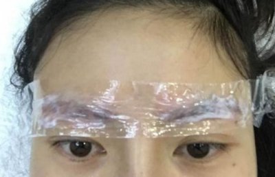 激光洗眉毛后多久可以再纹眉 洗完眉毛多久可以重新纹