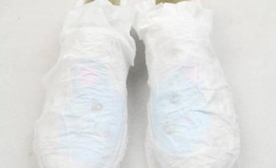 白鞋边发黄是什么原因 白鞋刷完有黄印子怎么去除