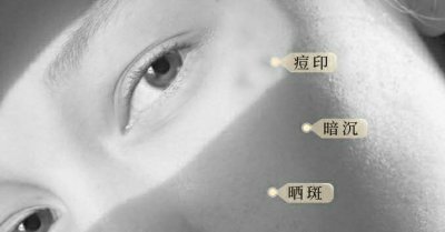 胶原蛋白为什么会流失? 面部胶原蛋白流失严重怎么办