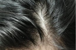 头发油怎么办？三个头发油解决小妙招