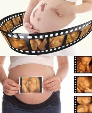 四维彩超是什么 孕妇做四维彩超的注意事项