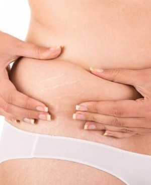 产后怎么减肥不影响哺乳？这些合理的方法值得一试