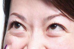 怎样消除眼袋？四个方法改善眼部衰老的征兆