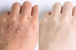 怎样变白全身小妙招？三个让皮肤变白的方法