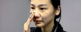毛孔堵塞怎么解决 堵塞毛孔要怎样修复
