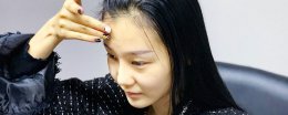 脸部会疤痕增生吗 脸部疤痕增生了怎么办