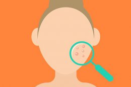 壳聚糖对痘印有效果吗 壳聚糖护创凝胶能淡化痘印吗