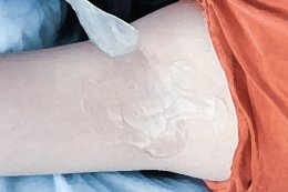 腋下用脱毛膏脱毛有危害吗 脱毛膏脱腋下毛腋下就老爱出汗这是为什么？