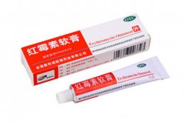 祛痣后有红印可以化妆吗 脸上祛痣后的红色坑印可以用红霉素吗