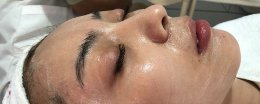 灌肤用什么刮脸最好 灌肤用勺子刮脸是真的吗