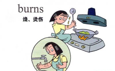 烧烫伤之后怎么处理 介绍5种常见的处理方法