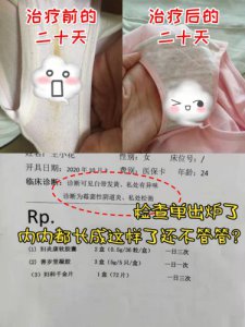 我最爱的妇科用药~你们有发现吗？